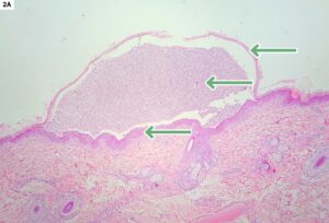 derma inmunitarias 2A