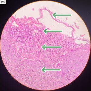 derma inmunitarias 2B