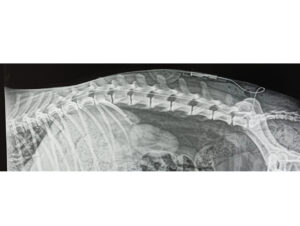 Comprobación de la ubicación del catéter epidural mediante radiografía con contraste.
