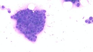 Neoplasia mamaria canina benigna. Imagen 1. Neoplasia mamaria canina benigna.