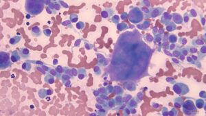 Neoplasia mamaria canina maligna: osteosarcoma mamario. Imagen 2. Neoplasia mamaria canina maligna: osteosarcoma mamario.