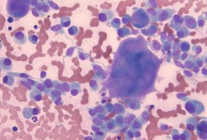 Imagen 2. Neoplasia mamaria canina maligna: osteosarcoma mamario.