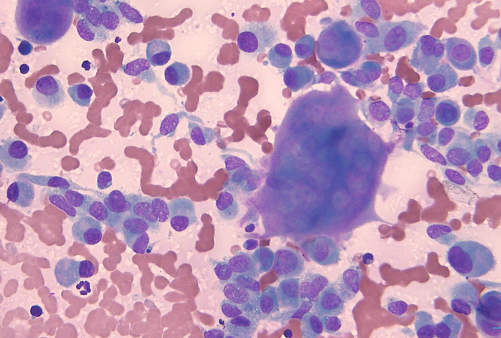 Imagen 2. Neoplasia mamaria canina maligna: osteosarcoma mamario.