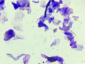 Imagen citológica de un sobrecrecimiento bacteriano en el oído de un perro (imagen cedida por Isaac Carrasco).