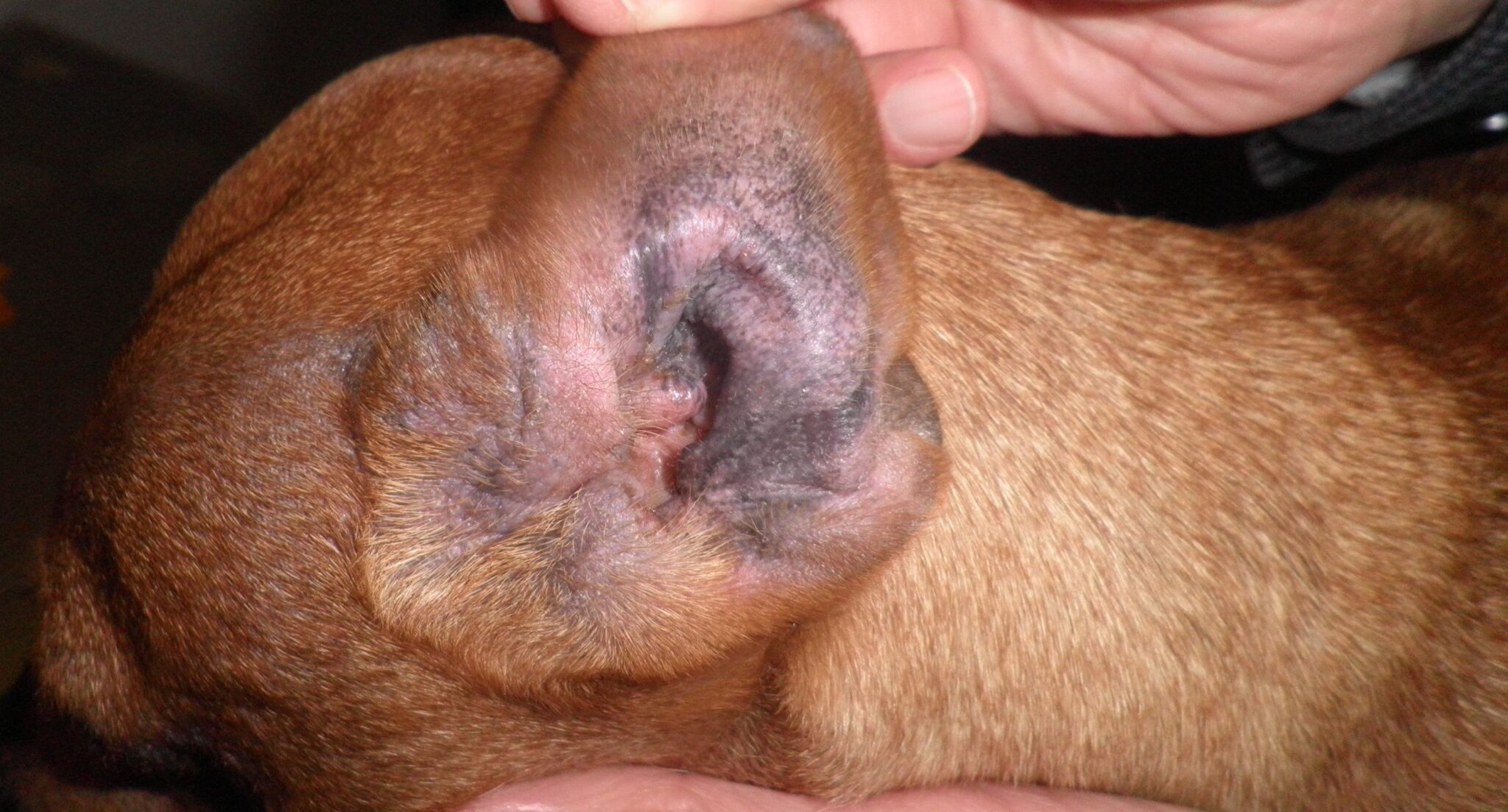 Otitis eritematosa con hiperpigmentación moderada del pabellón auricular externo en un paciente atópico.
