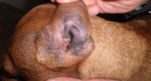 Otitis eritematosa con hiperpigmentación moderada del pabellón auricular externo en un paciente atópico.