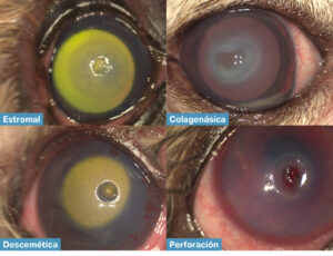 Ejemplos de diversas úlceras complicadas en función de su profundidad.