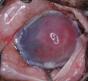 ba6 ulceras imagen4b.jpg