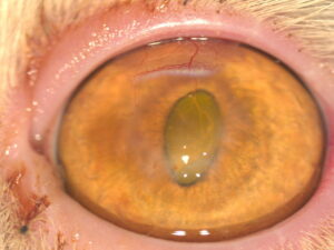 ba6 ulceras imagen6C