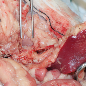 Imágenes quirúrgicas durante una pancreatectomía parcial del lóbulo izquierdo en un gato, por una lesión provocada por una mordedura, usando un sellador vascular/tisular.