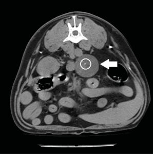 Imagen de TC en plano transversal en ventana de tejidos blandos sin contraste (A) de un adenocarcinoma (flecha blanca)