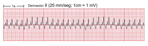 Electrocardiograma de perro mestizo, macho, de 5 kg y 12 años.
