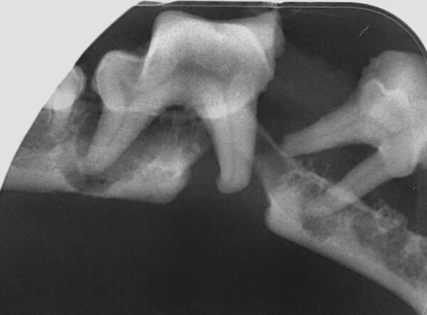 Fracturas iatrogénicas del cuerpo mandibular a nivel del primer molar (409) por enfermedad periodontal grado 4 en dos perros de talla pequeña.