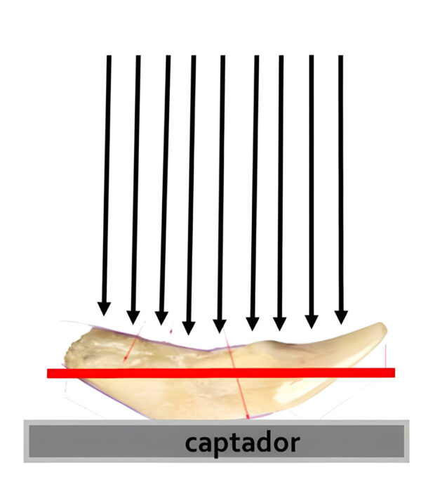 Diagrama que muestra un diente y un captador en odontología