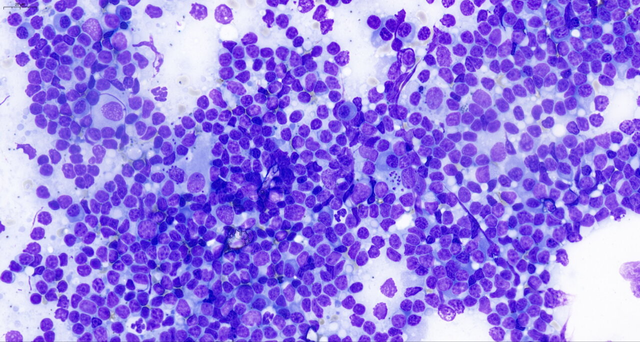 Muestra microscópica mostrando células relacionadas con leishmaniosis