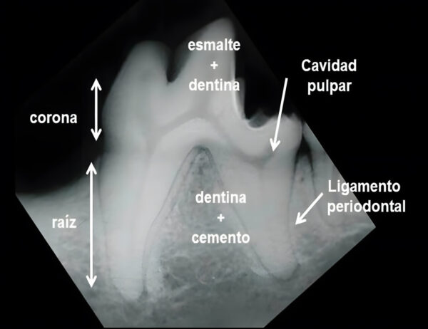 Radiografía mandibular de un primer molar (409).