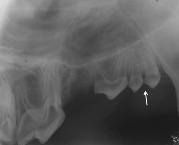 Valoración radiológica del estado de la raíz de un canino maxilar deciduo (604) en un perro y su relación con los dientes definitivos previa a su extracción.