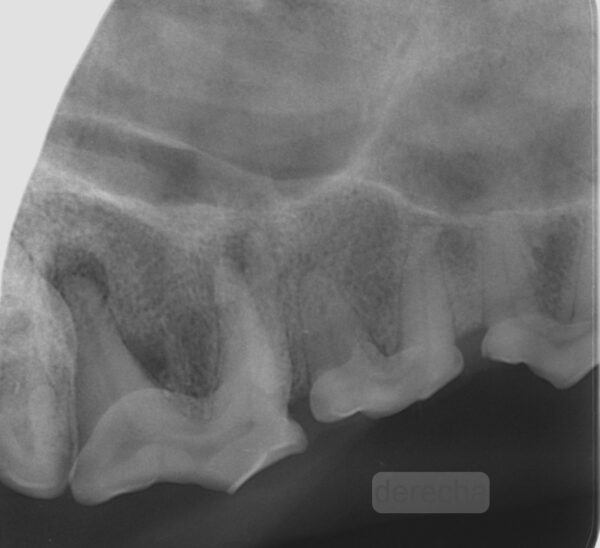 Absceso apical en un cuarto premolar maxilar (108) en un perro que le había provocado una fístula a nivel infraorbitario.