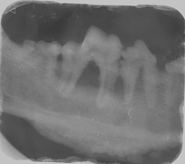 Aspecto radiológico de un CCE en un perro. Obsérvese la reacción perióstica de la rama mandibular.