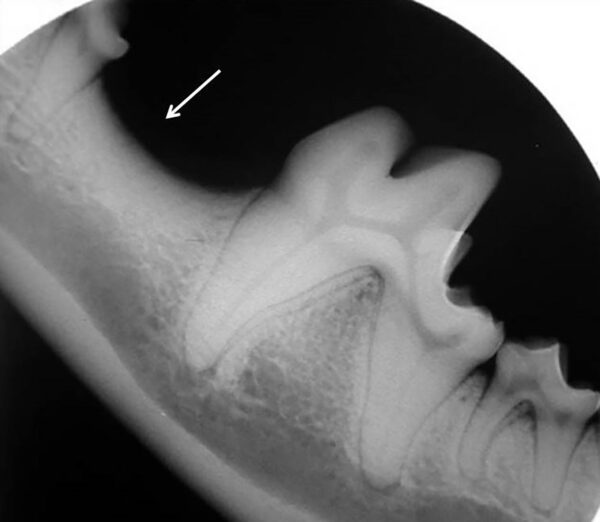 Ausencia de un cuarto premolar mandibular (308) en un perro (flecha).
