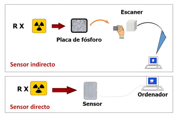 Esquema de sensor digital indirecto y directo.
