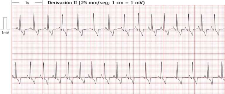 Electrocardiograma de perro