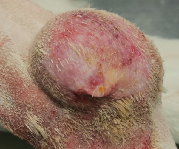 Sarcoma de tejidos blandos en el que la cirugía con márgenes adecuados resulta técnicamente compleja debido a la ubicación y características del tumor. En estos casos, la electroquimioterapia intraoperatoria se presenta como una alternativa eficaz para el control local de la enfermedad.