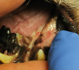Respuesta completa 30 días después del tratamiento con electroquimioterapia del melanoma oral de la imagen 18﻿.