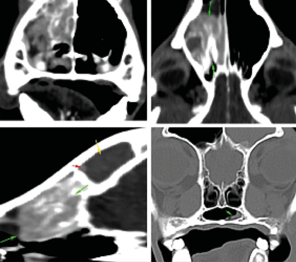 TC de planificación en tumor nasal caudal, estadio I según la clasificación de Adams modificada.
