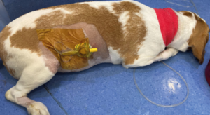 Imagen 4. Imagen de la paciente durante su hospitalización, donde se aprecia el catéter de bloqueo para manejo del dolor posoperatorio.