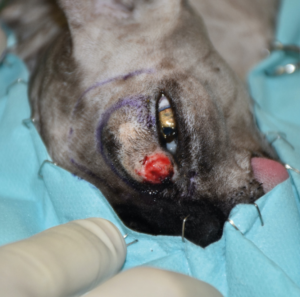 Imagen A. Secuencia quirúrgica de la resección oncológica en bloque incluyendo todo el párpado superior afectado, orbitectomía parcial dorsal y exenteración ocular, con ostectomía usando una sierra oscilante de parte del hueso nasal, y del hueso y seno frontal para garantizar márgenes amplios.