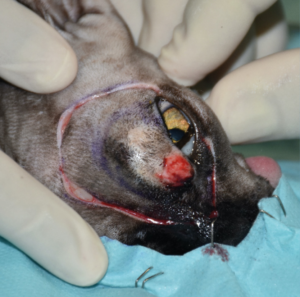 Imagen B. Secuencia quirúrgica de la resección oncológica en bloque incluyendo todo el párpado superior afectado, orbitectomía parcial dorsal y exenteración ocular, con ostectomía usando una sierra oscilante de parte del hueso nasal, y del hueso y seno frontal para garantizar márgenes amplios.