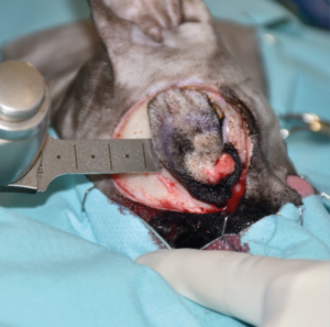 Imagen B. Secuencia quirúrgica de la resección oncológica en bloque incluyendo todo el párpado superior afectado, orbitectomía parcial dorsal y exenteración ocular, con ostectomía usando una sierra oscilante de parte del hueso nasal, y del hueso y seno frontal para garantizar márgenes amplios.