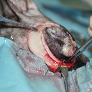 Imagen D. Secuencia quirúrgica de la resección oncológica en bloque incluyendo todo el párpado superior afectado, orbitectomía parcial dorsal y exenteración ocular, con ostectomía usando una sierra oscilante de parte del hueso nasal, y del hueso y seno frontal para garantizar márgenes amplios.