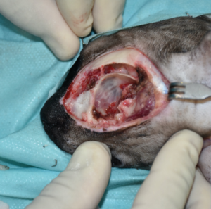 Imagen 2F. Secuencia quirúrgica de la resección oncológica en bloque incluyendo todo el párpado superior afectado, orbitectomía parcial dorsal y exenteración ocular, con ostectomía usando una sierra oscilante de parte del hueso nasal, y del hueso y seno frontal para garantizar márgenes amplios.