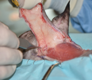 Imagen 3B. Imágenes 3A-3F. Secuencia quirúrgica de la realización del colgajo axial insular auricular caudal para cubrir el defecto creado tras la resección oncológica.