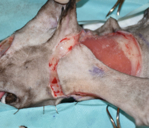 Imagen 3C. Imágenes 3A-3F. Secuencia quirúrgica de la realización del colgajo axial insular auricular caudal para cubrir el defecto creado tras la resección oncológica.