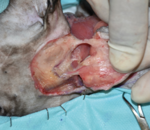 Imagen 3D. Imágenes 3A-3F. Secuencia quirúrgica de la realización del colgajo axial insular auricular caudal para cubrir el defecto creado tras la resección oncológica.