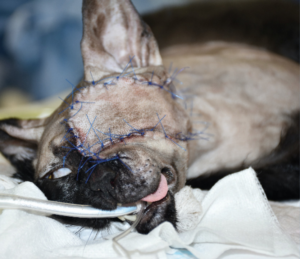 Imagen 3F. Imágenes 3A-3F. Secuencia quirúrgica de la realización del colgajo axial insular auricular caudal para cubrir el defecto creado tras la resección oncológica.