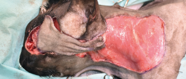 Imágenes quirúrgicas de un colgajo axial insular auricular caudal siendo rotado cranealmente 180 grados, donde el donante y el receptor están a distancia, por lo que se crea una incisión en puente para unir ambos defectos, retirándose un pequeño fragmento del puente con el fin de lograr un resultado más estético.