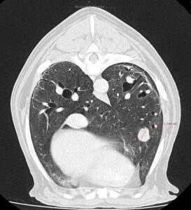 Evolución de lesiones pulmonares metastásicas en el tiempo. Evolución de enfermedad local en el tiempo. El nódulo visible en el TC 28 meses tras RT se trata de una nueva localización, sin evidencia de progresión de los nódulos metatásicos iniciales.