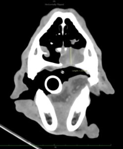 Evolución de enfermedad local en el tiempo. El nódulo visible en el TC 28 meses tras RT se trata de una nueva localización, sin evidencia de progresión de los nódulos metatásicos iniciales.