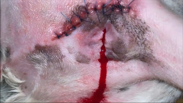 Imagen 3. Complicación posquirúrgica: hemorragia activa de la arteria pudenda interna.