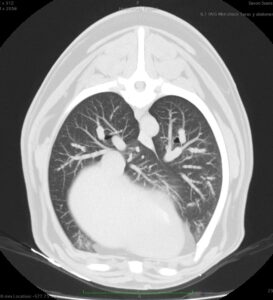 Evolución de lesiones pulmonares metastásicas en el tiempo. Tras 18 meses los nódulos pulmonares han desaparecido casi por completo tras RT.
