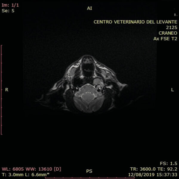 IRMN de un paciente felino con otitis media. Se aprecia contenido en la bulla timpánica izquierda.