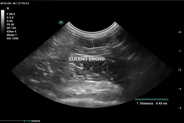 Imagen ecográfica correspondiente a una coneja de 7 años de edad y 1,2 kg, que evidencia un engrosamiento de la pared del cuerno uterino derecho y la presencia de formaciones quísticas intraparietales.