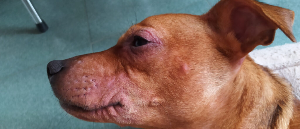 lopecia perilabial eritematosa con escoriaciones.