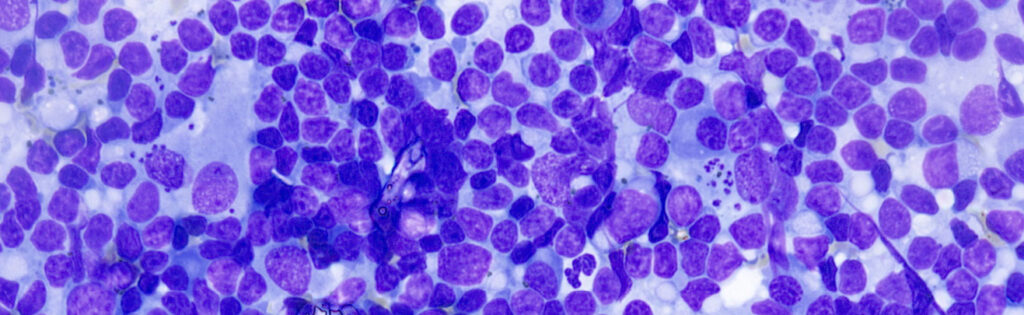 Células en un microscopio con coloración púrpura