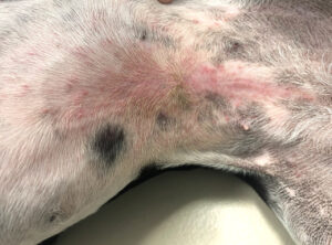 Imagen 1A.﻿ Eritema inguinal moderado, con pápulas aisladas.﻿