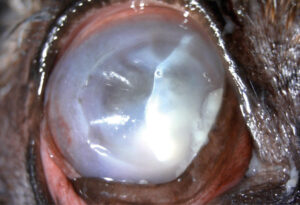 Úlceras complicadas. Estromal profunda con queratomalacia.﻿